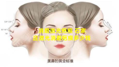 消磨激光疤痕 石家庄激光消磨疤痕多少钱